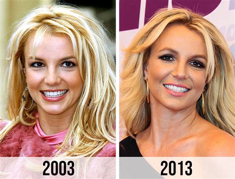 Did Britney Spears Get Plastic Surgery Over The。